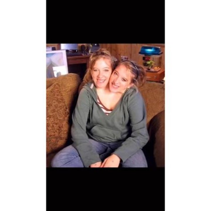 Conjoined Twins Abby and Brittany: Sad News and Their Remarkable Journey