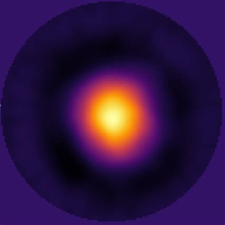 EIT: The Revolutionary Technology Explained