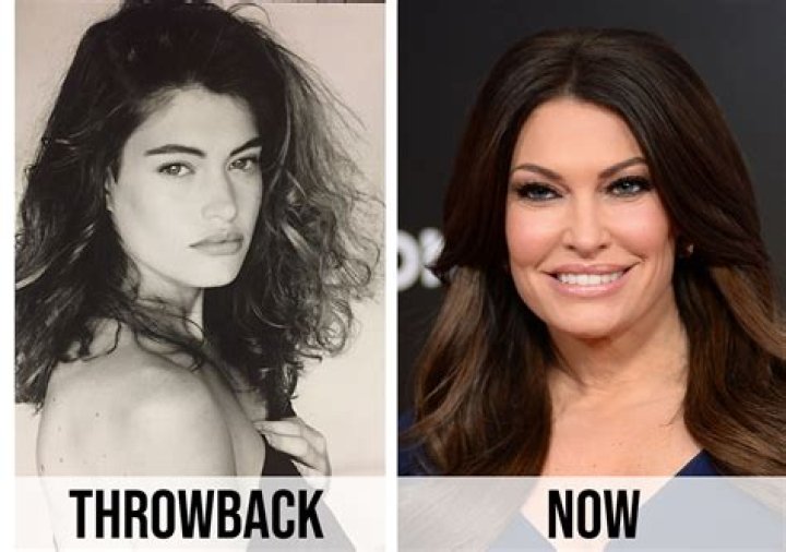 What Did Kimberly Guilfoyle Do to Her Face? Uncovering the Truth Behind Her Transformation